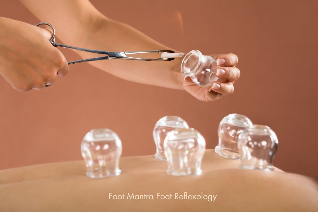 Experience Healing at the Best Cupping Clinic in Chennai – Balanz Nature Cure
