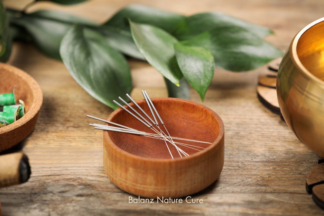 Discover the Best Acupuncture Clinic in Chennai: Balanz Nature Cure